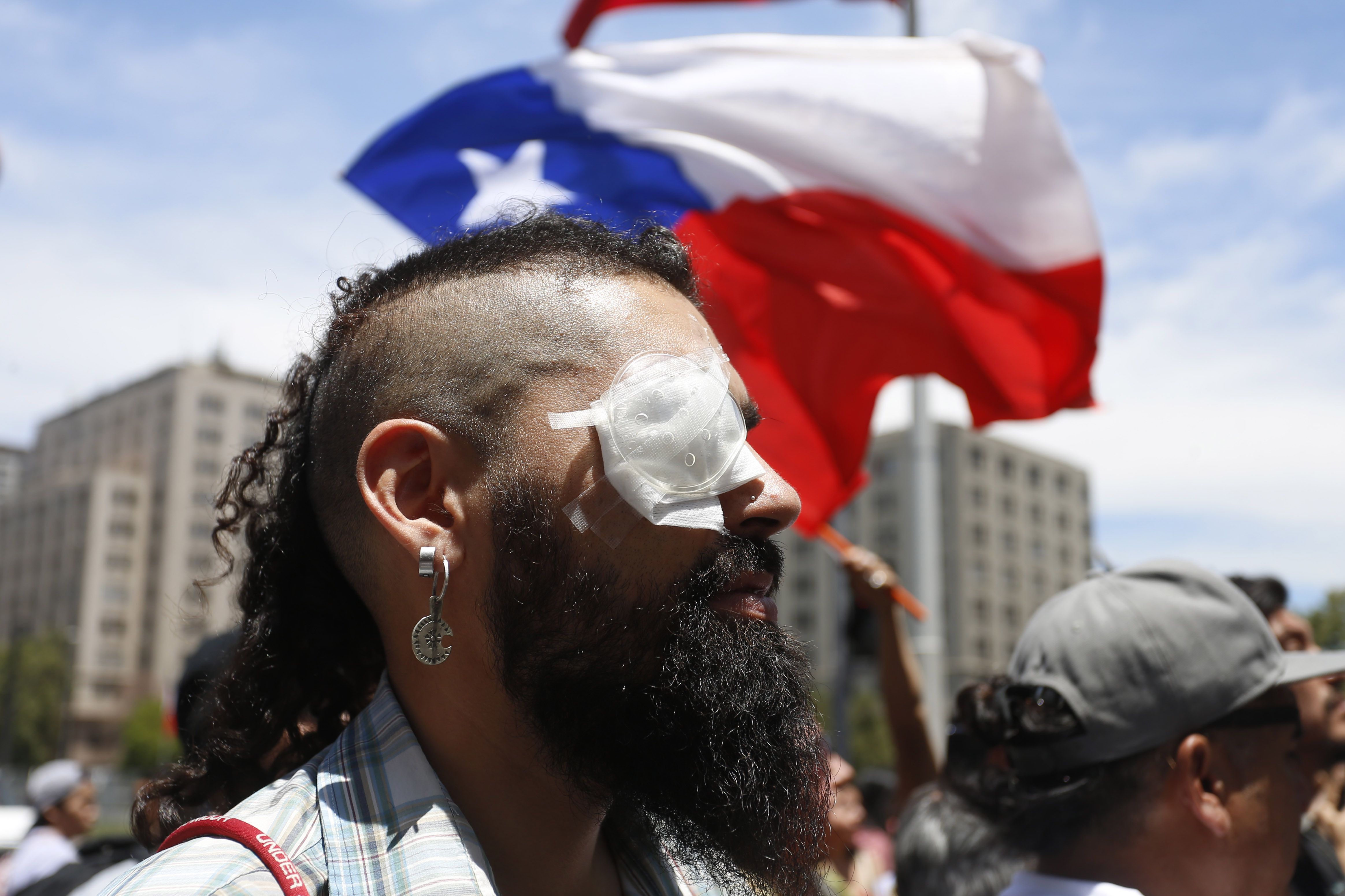 UN report on Chile protests finds severe human rights abuses. Image via Yahoo News.